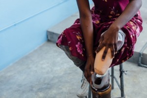 Magna visits St. Vincents and the Haiti Amputee Coalition about every 4 months for check ups or to make adjustments to her prosthetics.