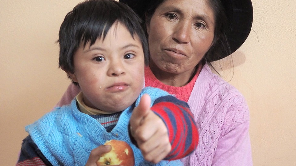 chilod with down syndrome in Peru