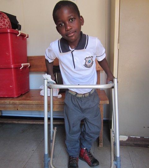 Senzelwe from Swaziland born with club feet in Swaziland now standing on his own two feet