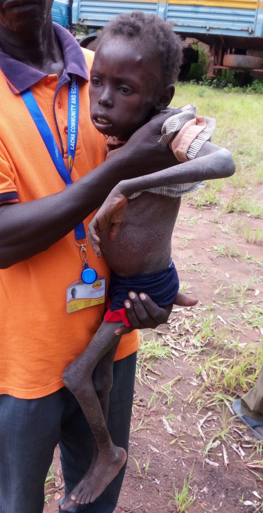 Sami in the arms of a health worker. He was too weak to walk.