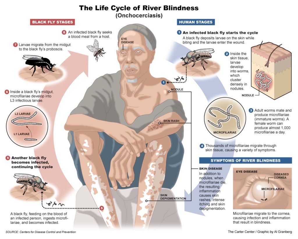 Life cycle of river blindness a neglected tropical disease.