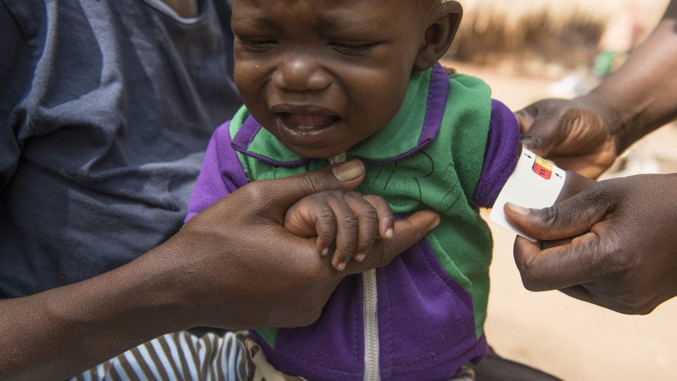 South Sudan_child at Rimenze IDP camp examined for malnutrtion_photog Charles Lomodong