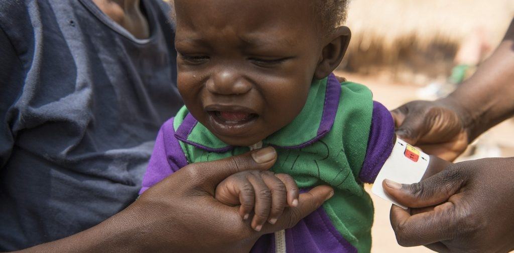 A young South Sudanese child receives medical care.