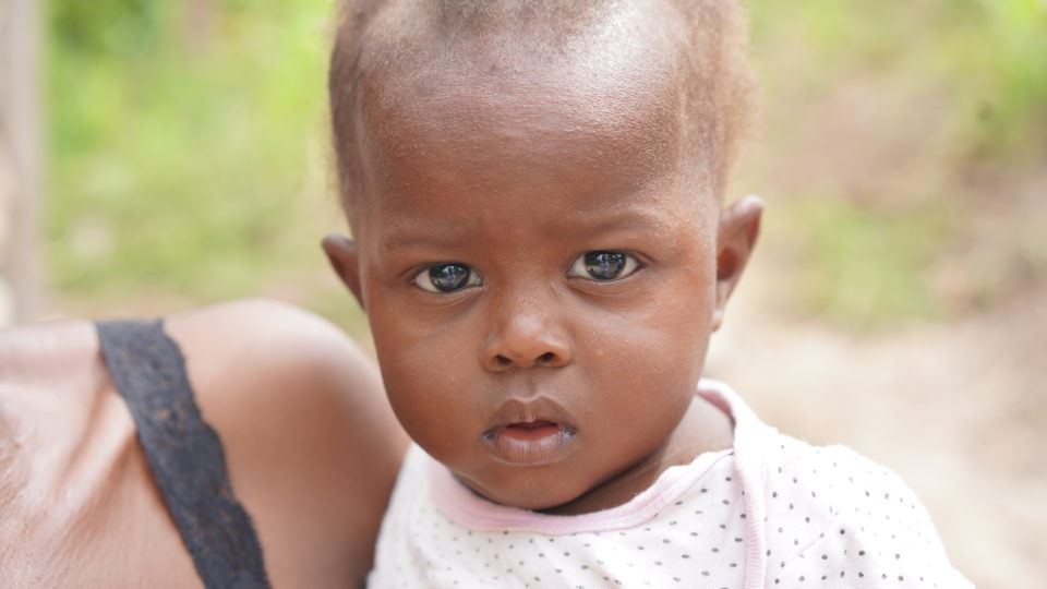 Jean Ali Jean Ali is a 6-month-old baby living in a remote mountain area in Haiti. She needs an Angel Investor so she can have access to quality healthcare.