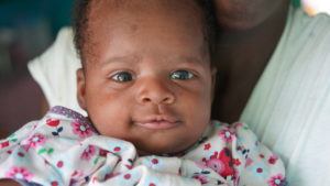 Close-up of Baby Rubens at his home in Haiti. He needs an Angel Investor for healthcare.