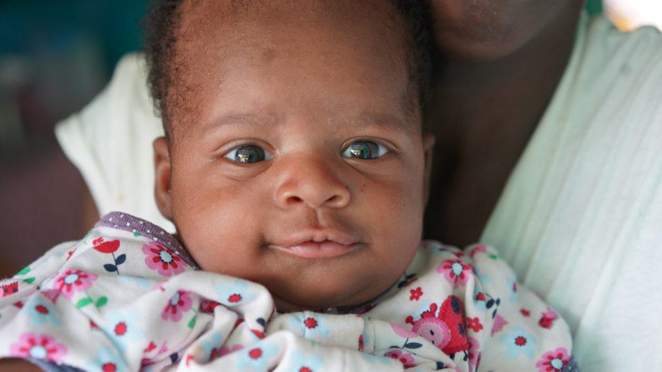 Close-up of Baby Rubens at his home in Haiti. He needs an Angel Investor for healthcare.