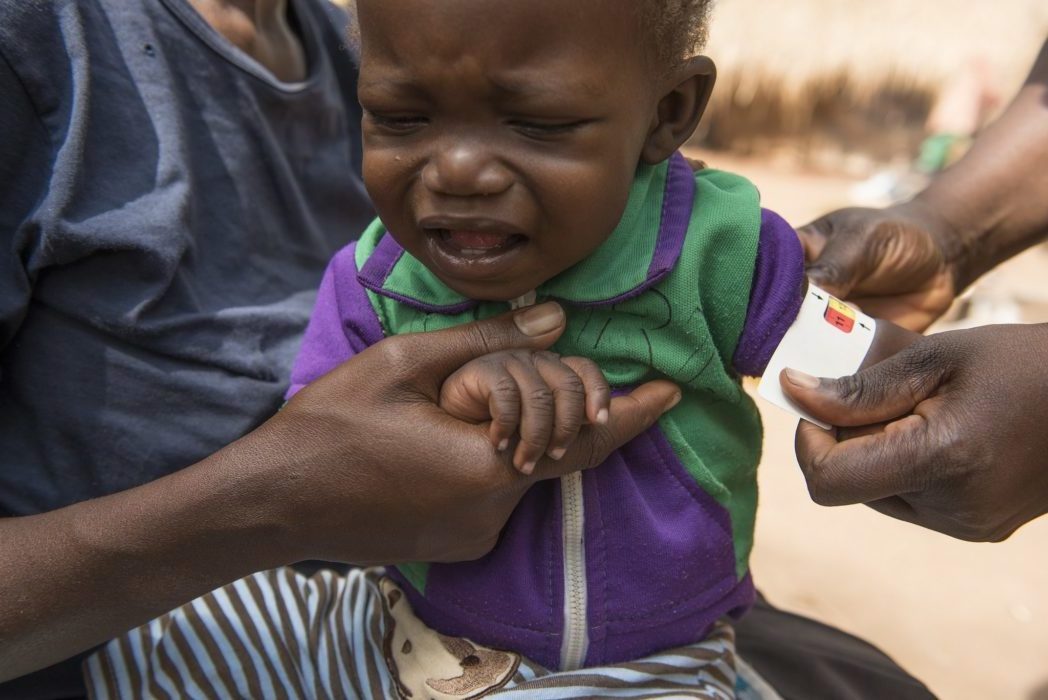 measuring for malnutrition in children