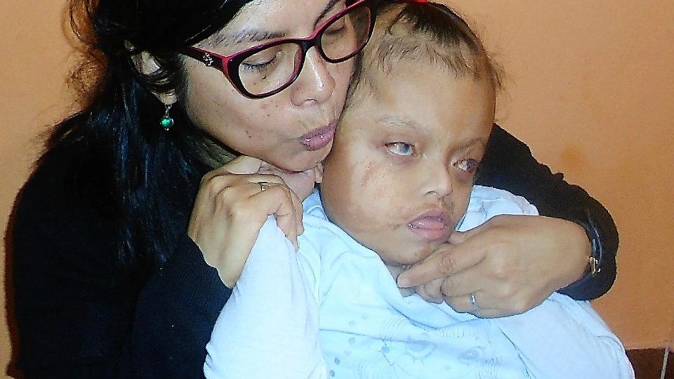 Milusaca faces many challenges. But, she is a bright little girl - CMMB Peru Angel