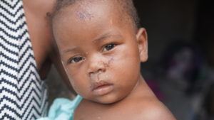 Portrait of baby Paulson in Haiti.
