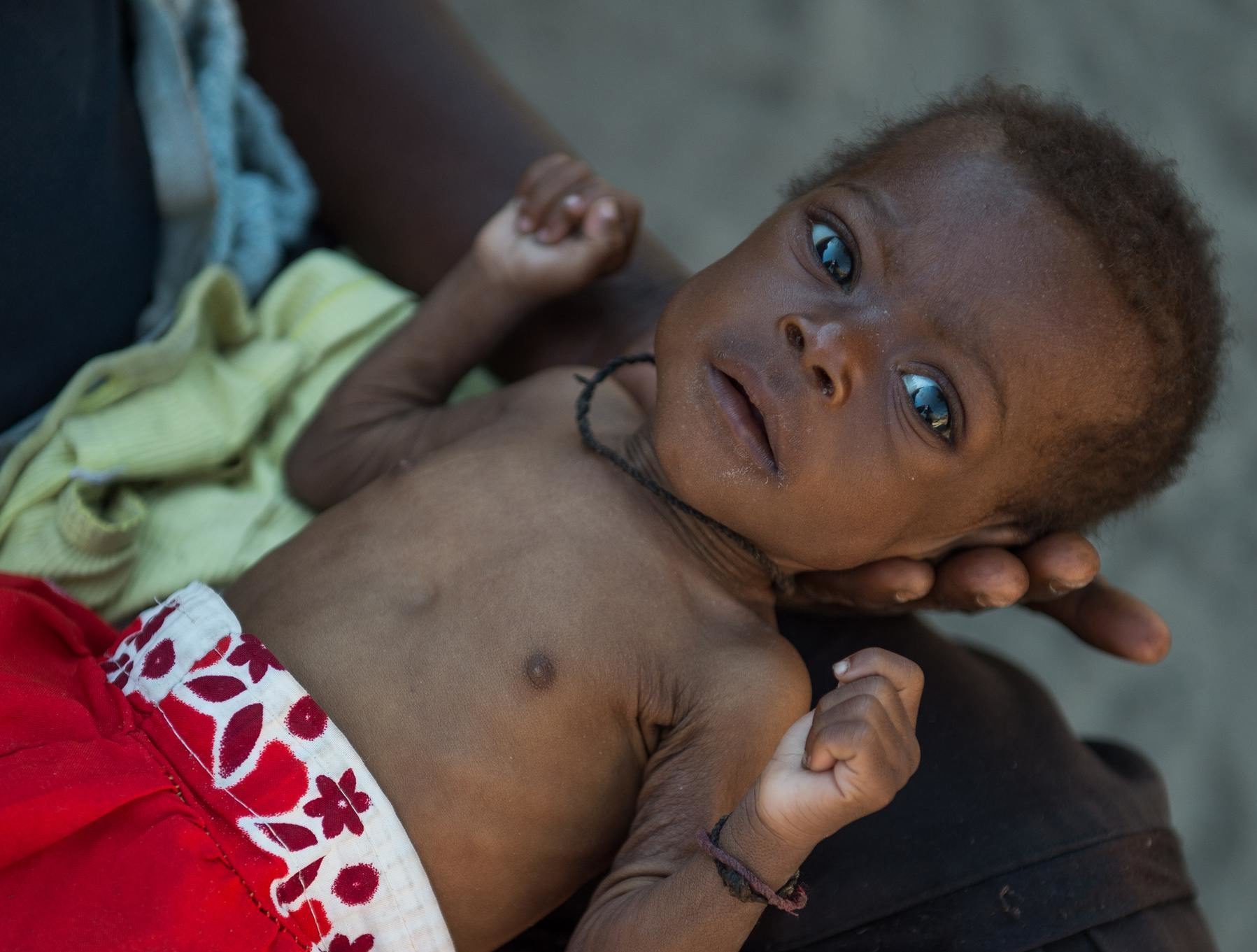 Baby Innutu needs your help. Red zone call to action pop up