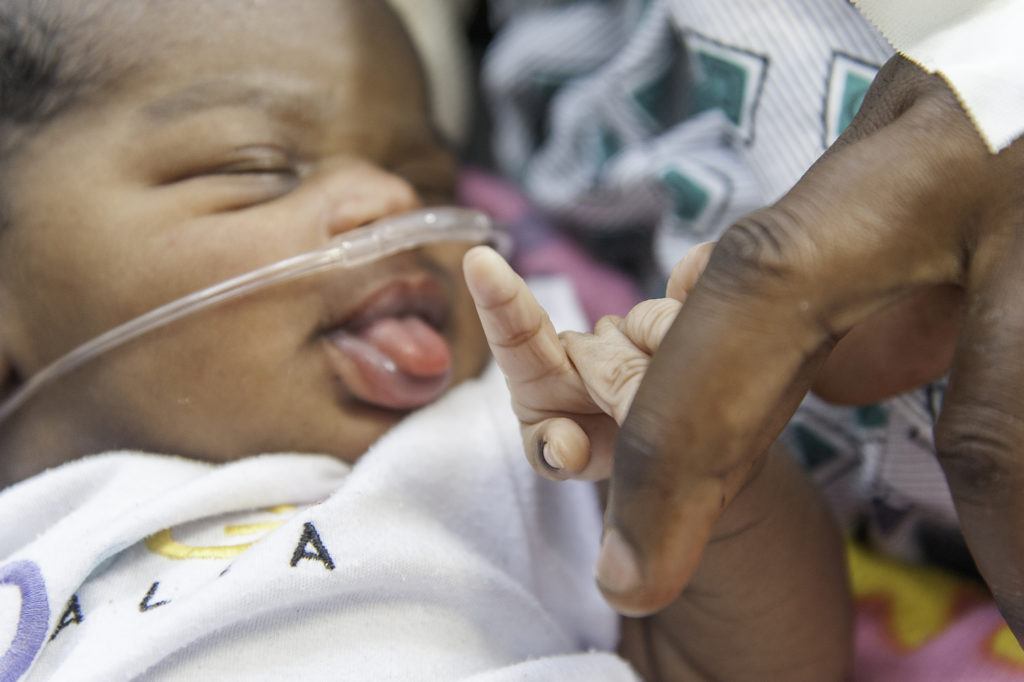 Jacinthe's baby after being resuscitated at the BJSH in Haiti.