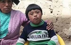 Kenji in Peru has down syndrome