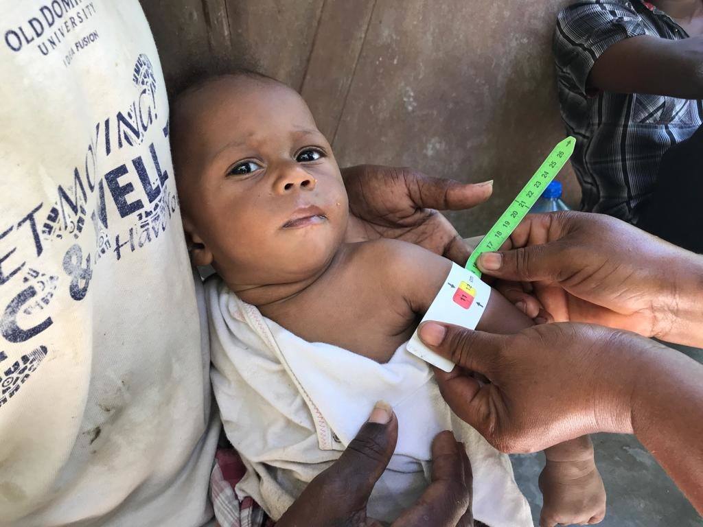 Djethro is 8 months old and severely malnourished