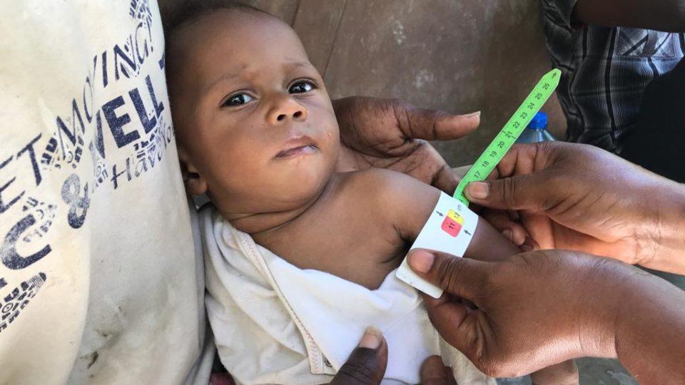 Djethro is 8 months old and severely malnourished