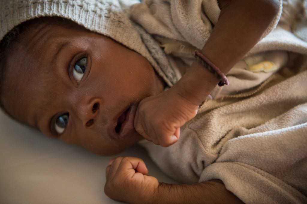 Baby Ing'nutu at Mwandi Mission Hospital receiving essential care