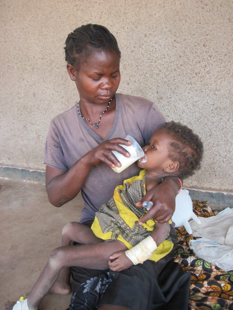 Jackline (23 months) receiving F100 formula from her aunt Elizabeth. Her mother died from AIDS related complications and she is severely malnourished. 