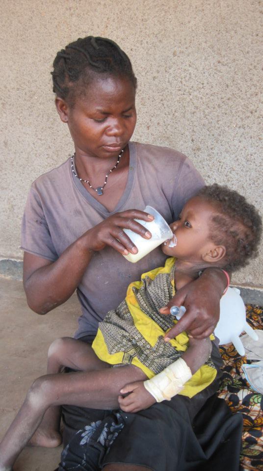 Jackline (23 months) receiving F100 formula Jackline (23 months) receiving F100 formula from her aunt Elizabeth. Her mother died from AIDS related complications and she is severely malnourished.