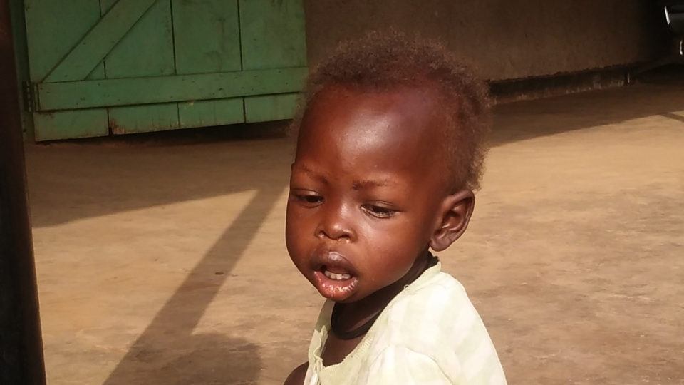 Ajok suffers from malnutrition. This photo was taken during his treatment at St. Therese Hospital in South Sudan. She sits outside the hospital on the ground