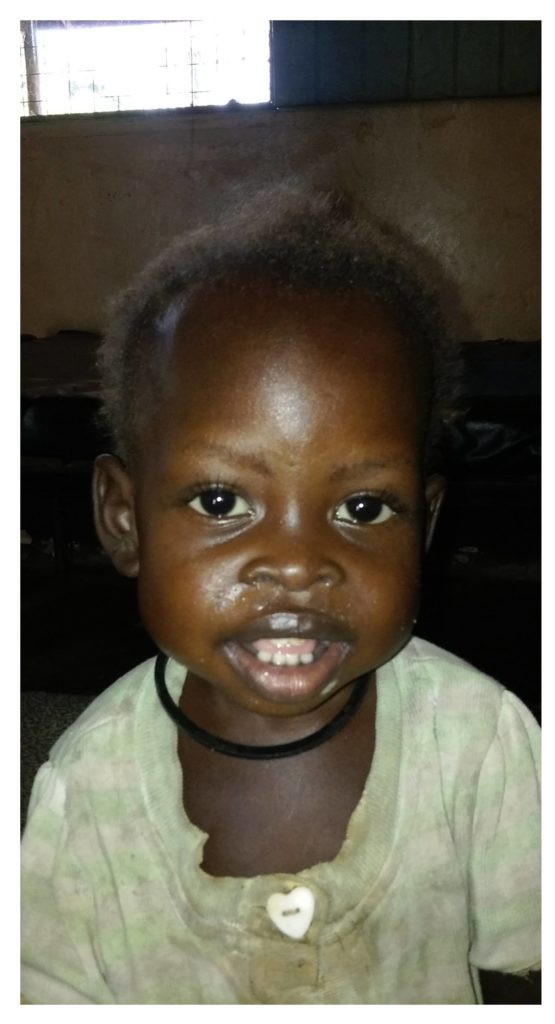 A collage featuring two images of baby Ajok. In the first she is smiling after recieving malnutrition treatment. In the second photo she is playin outside with her mother