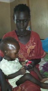 Baby Ajok is being held by her mother at the St. Therese Hospital in South Sudan