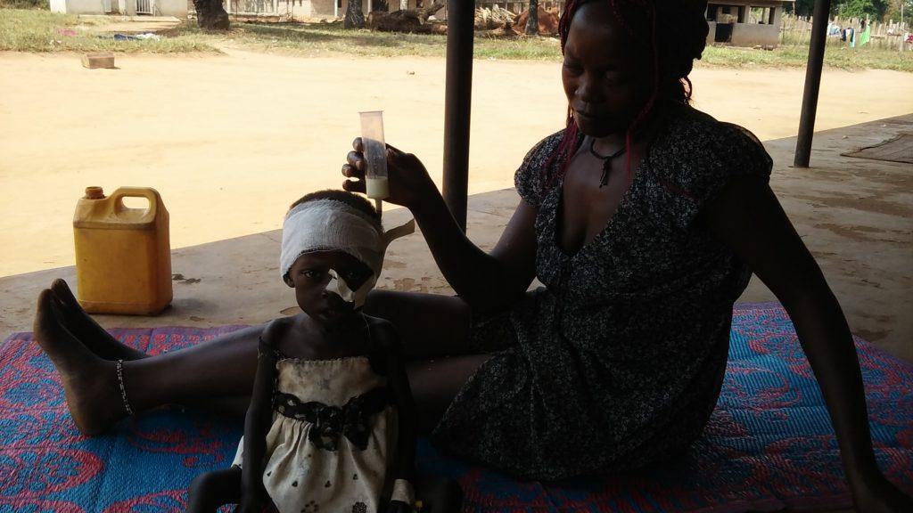 Baby Jenifer sits with her mother outside. She is being fed with a feeding tube 