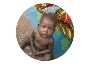 A young baby boy from South Sudan stares up at the camera. He is malnourished and sick.