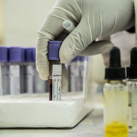 A hand holding a vial for HIV AIDS Testing in Kenya in July 2017