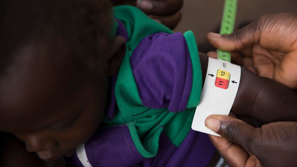 A child's arm being measured for red zone maluntirtion in Rimenze internally displaced persons camp in South Sudan in December 2017.